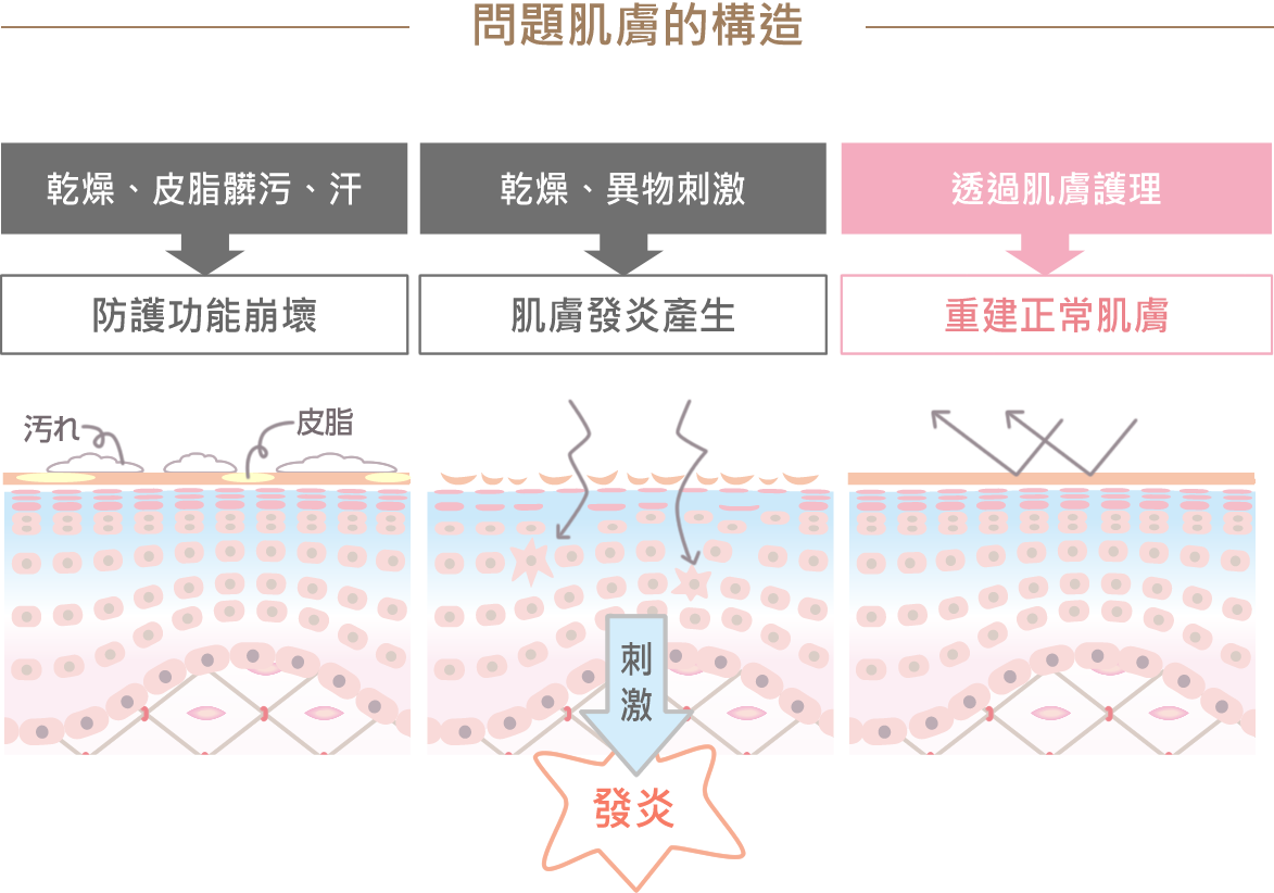 肌トラブルのしくみ